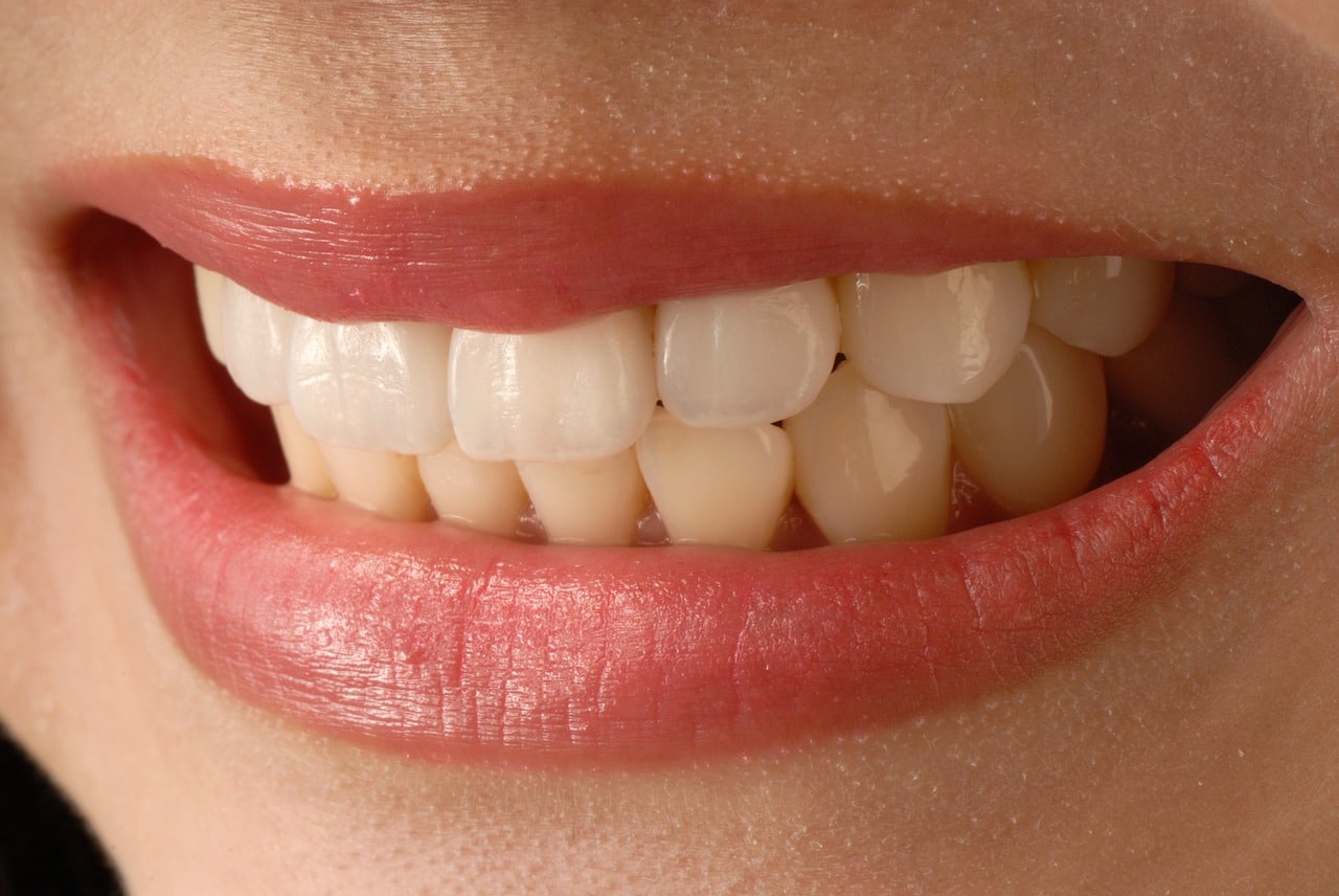 האם הלבנת שיניים יכולה לפגוע בבריאותן