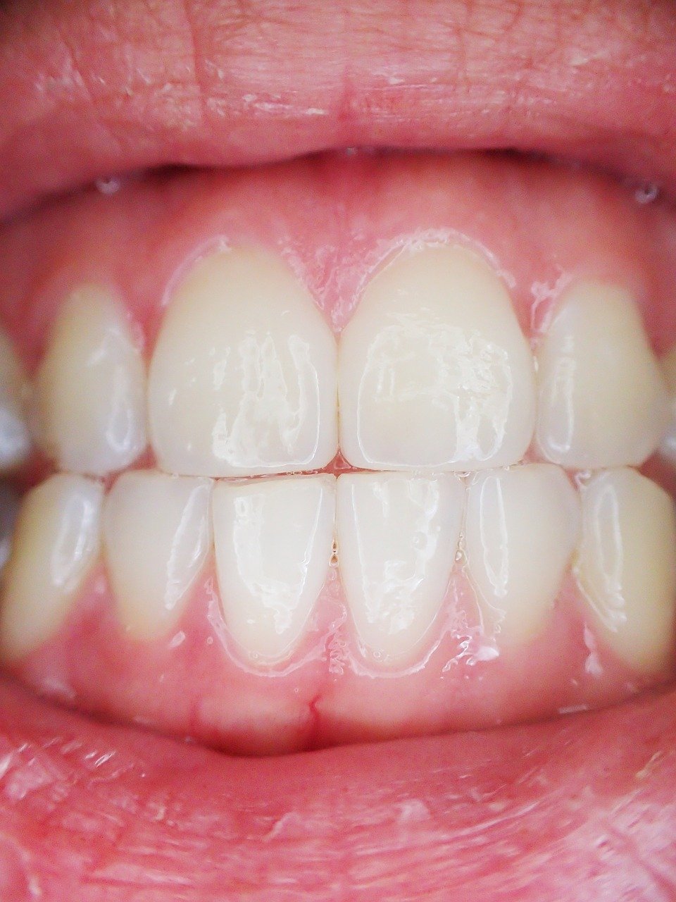 4 טיפים לבחירת רופא שיניים מקצועי