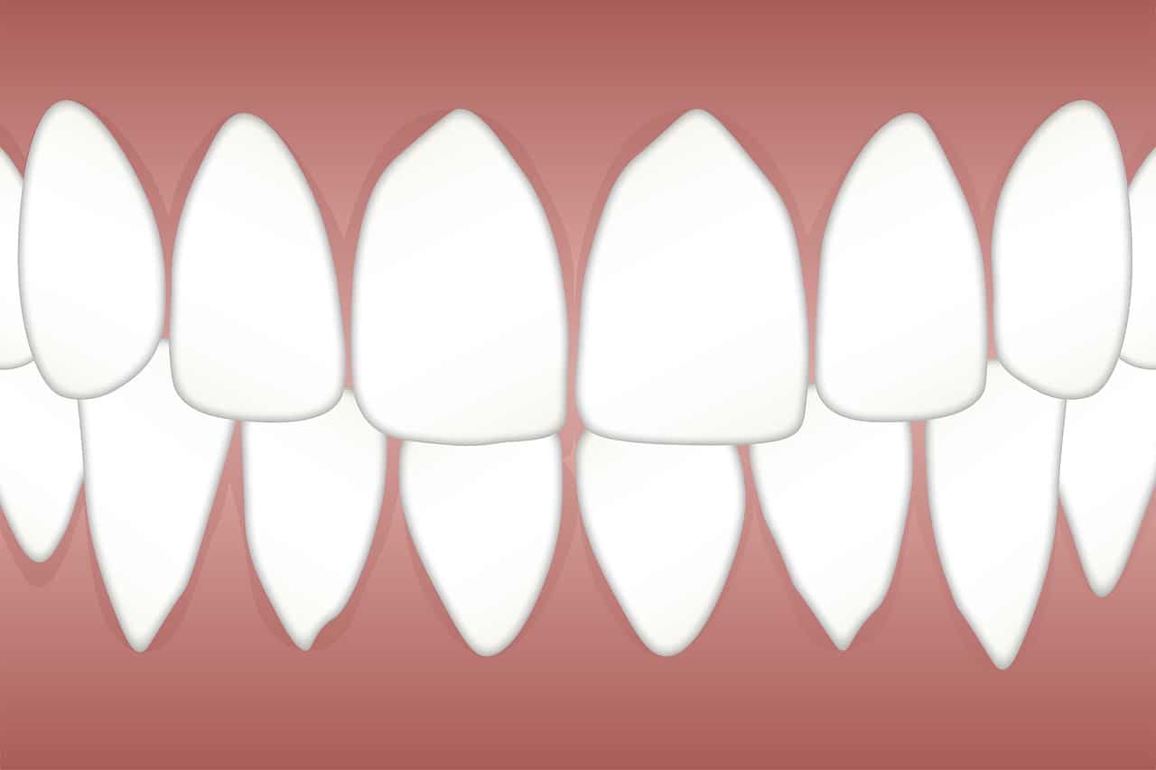 אילו טיפולי שיניים מומלץ לעשות אצל רופא רופא פרטי