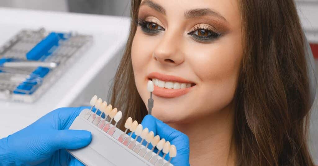 ציפוי חרסינה לשיניים - המדריך המקוצר